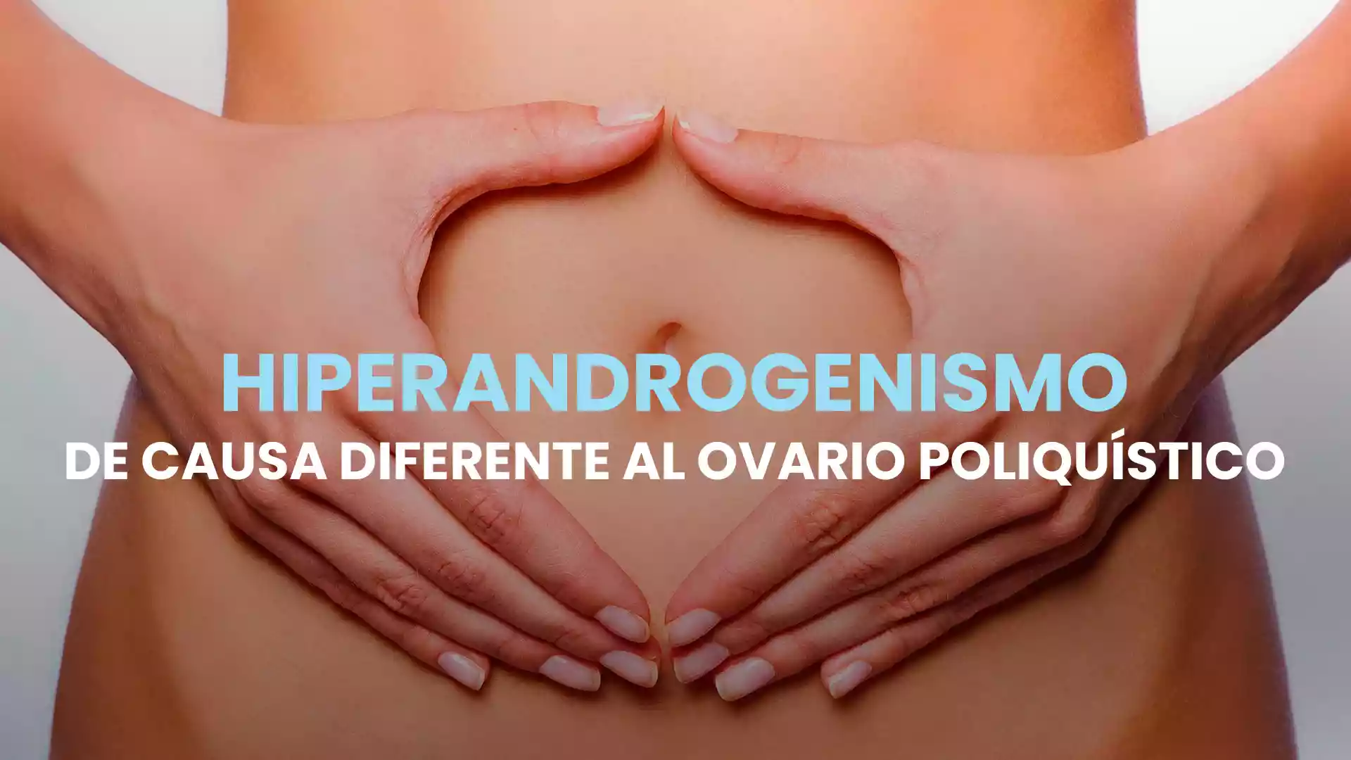 Hiperandrogenismo de causa diferente al ovario poliquístico