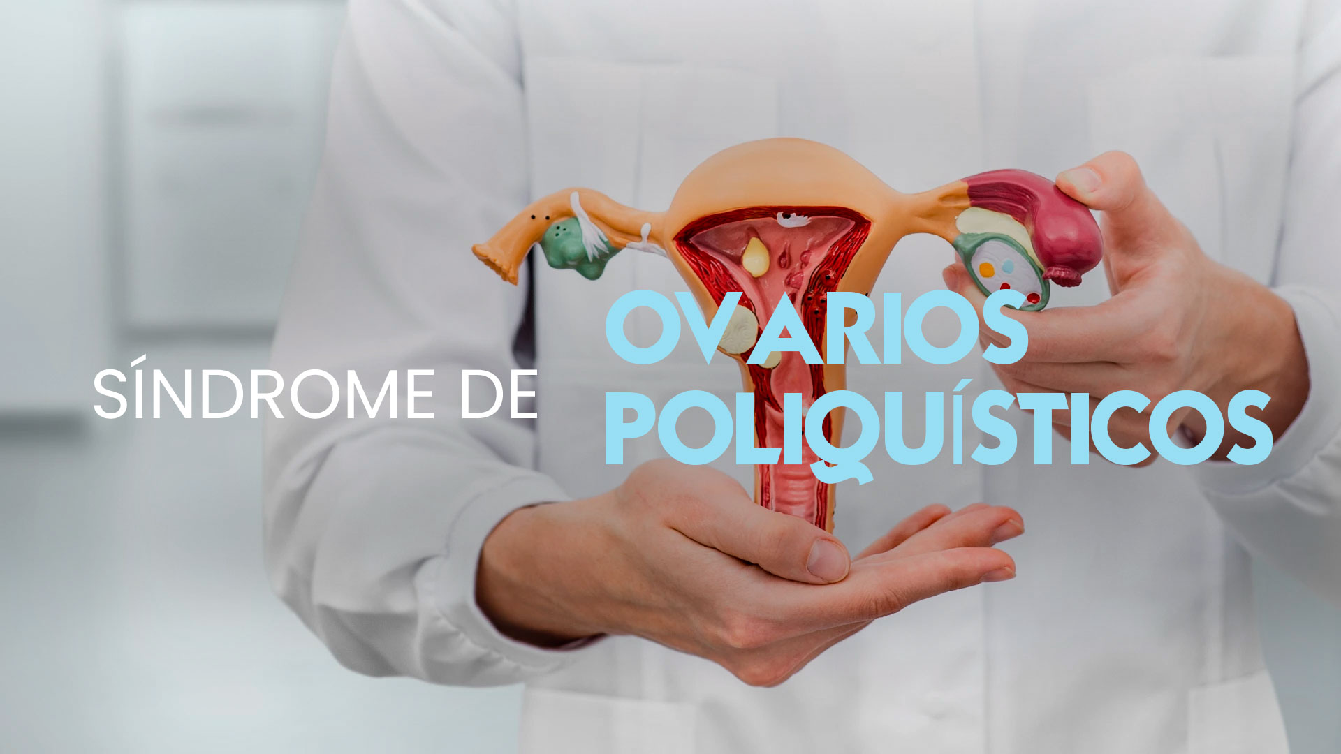 sindrome-ovarios-poliquisticos-01