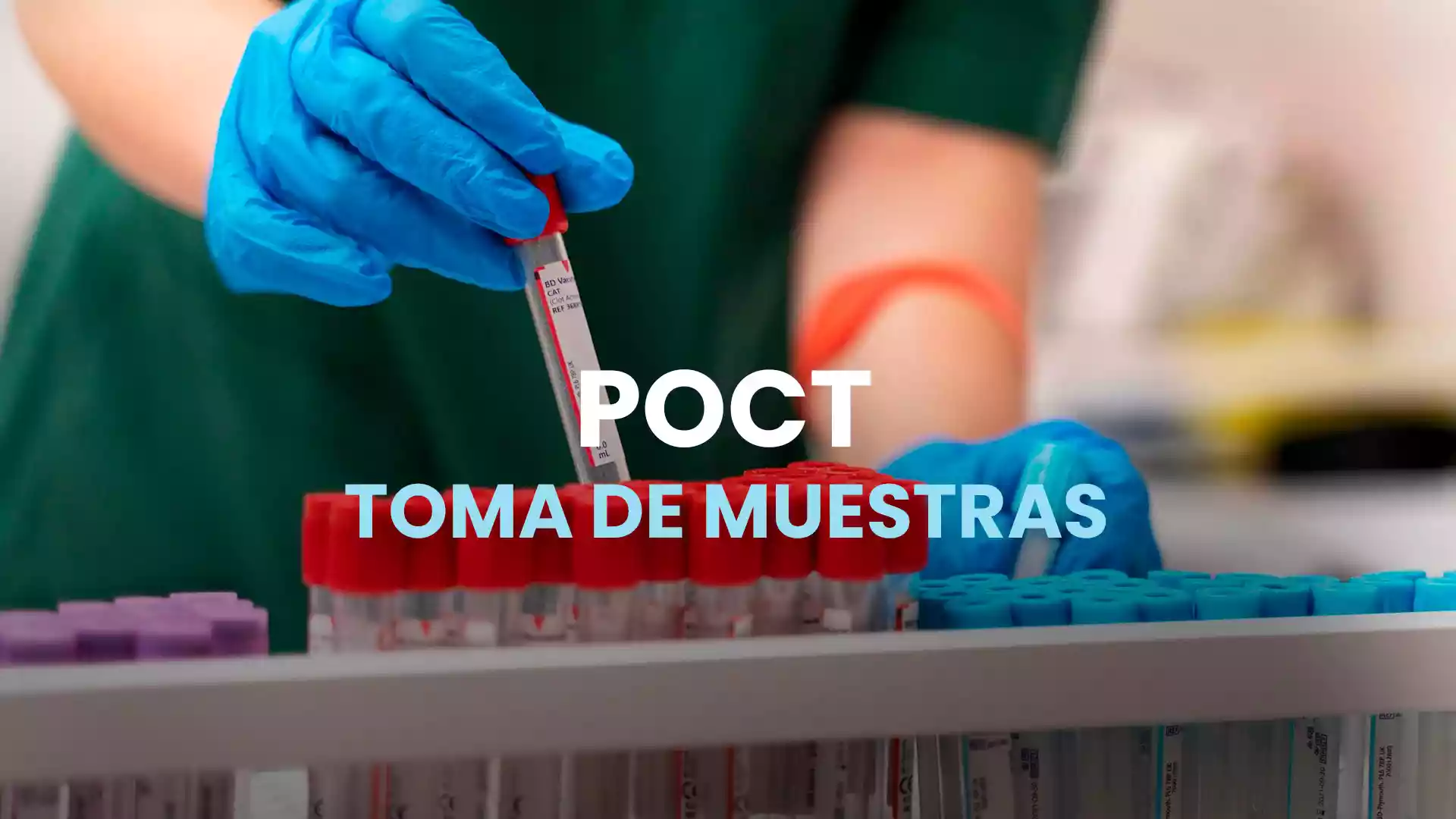 POCT – Toma de muestras